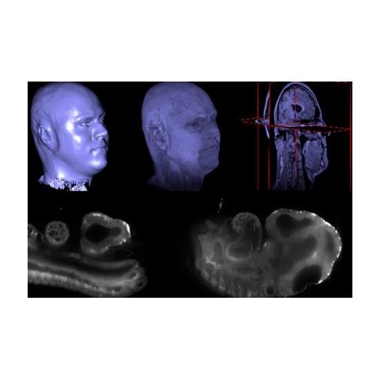 A 'WIKIPEDIA' FOR BIOMEDICAL IMAGES