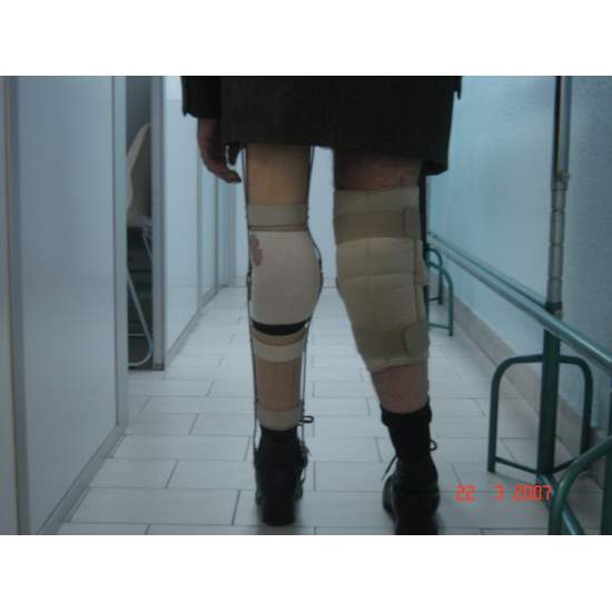 Reelle tilfælde af...