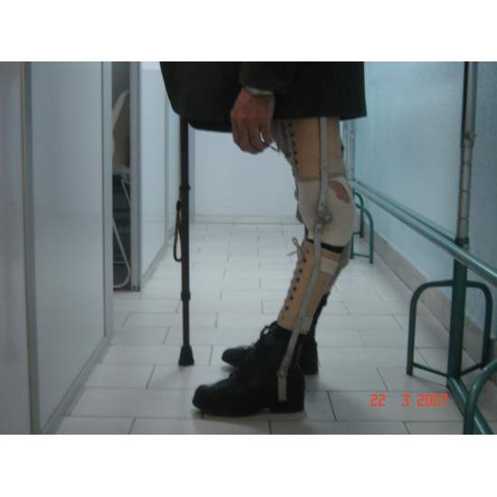 Run lengths apparatus 2