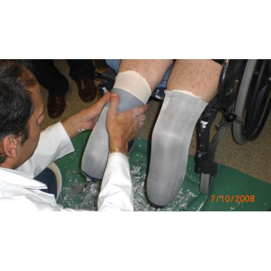 Bilateral amputação de membros inferiores