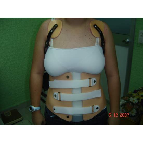 Corsetto sul paziente come