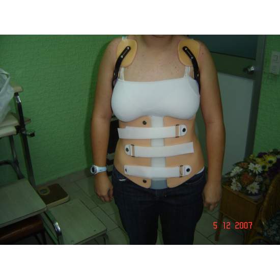 Corsetto sul paziente come 2