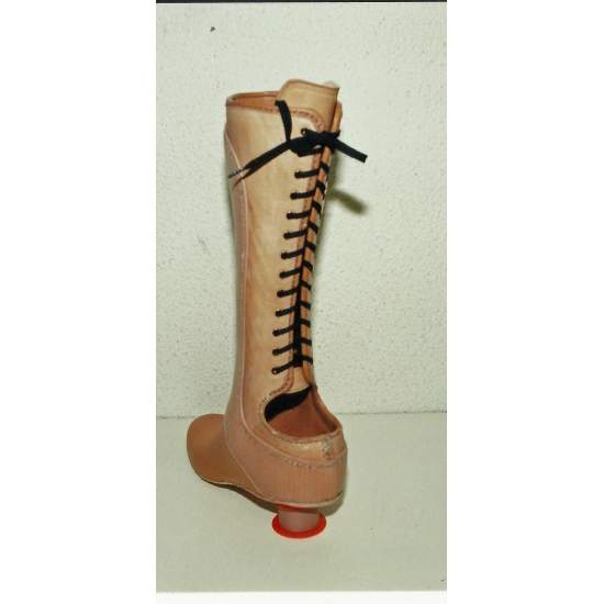 Chopart Prosthesis