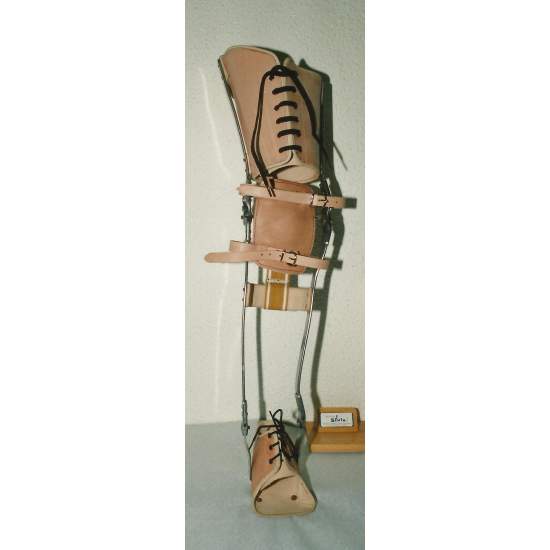 Run lengths apparatus