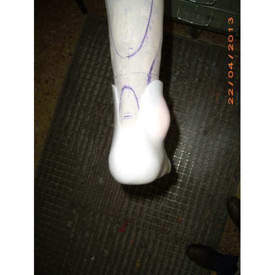 Dafo as on the patient