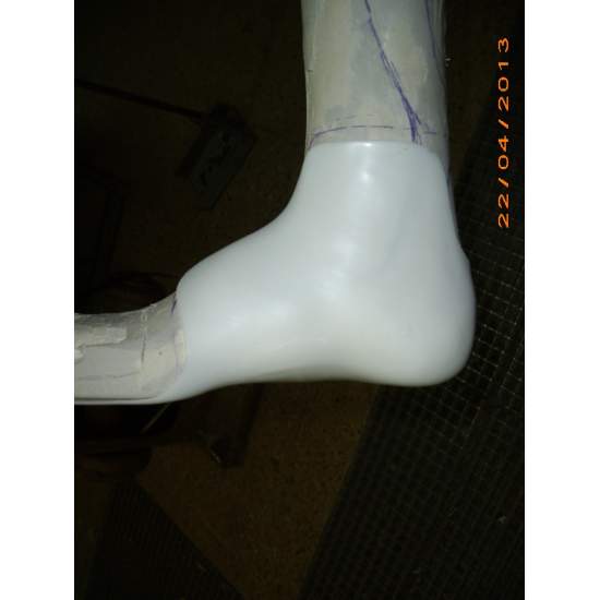 Dafo räätälöity potilaalle 2