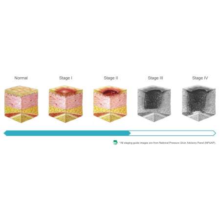 Domus 2 Antiescaras Mattress