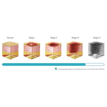 Domus 3 Anti-decubitus mattress