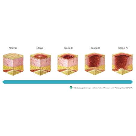 Domus 4 anti-decubitus mattress