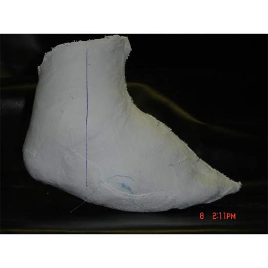 Custommade orthopedic shoes