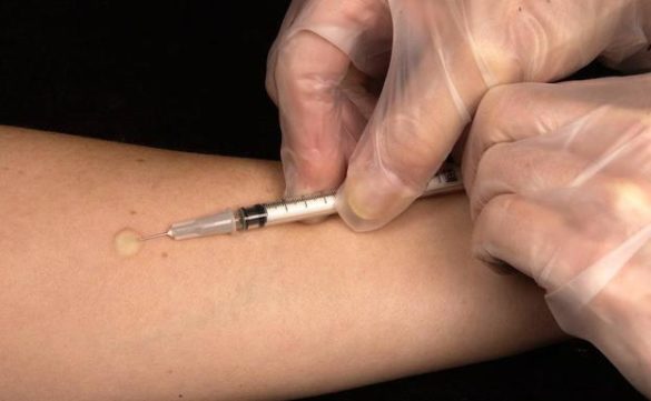 la-tuberculosis-puede-curarse-con-tratamientos-mas-cortos