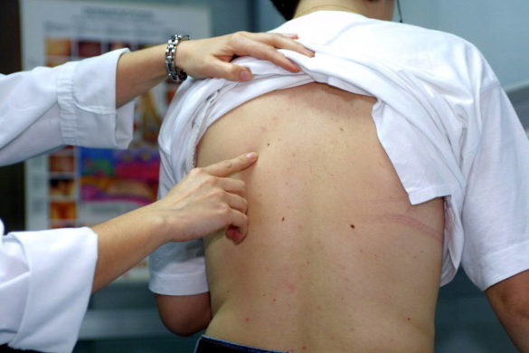 las-personas-altas-tienen-mas-riesgo-de-sufrir-un-cancer