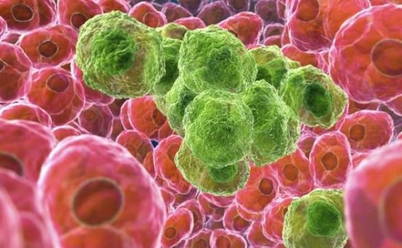 el-vinculo-entre-el-tamano-de-la-familia-y-el-riesgo-de-cancer