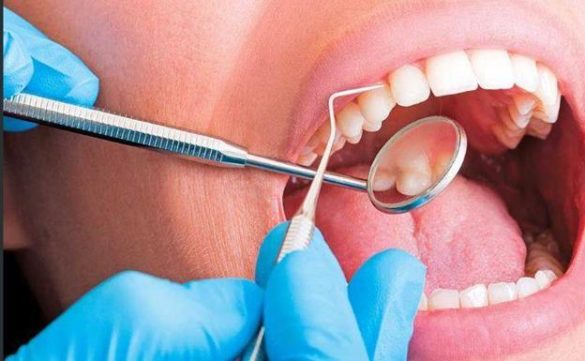 el-congreso-pide-al-gobierno-incluir-la-salud-bucodental-en-la-sanidad-publica