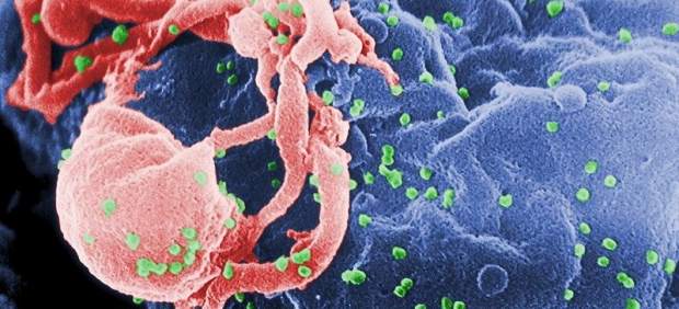 Virus del sida, VIH