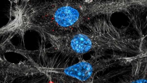 hallado-un-vinculo-entre-la-quimioterapia-y-la-metastasis-en-el-cancer-de-mama