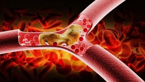 identifican-una-proteina-que-puede-elevar-el-8216colesterol-bueno8217-para-luchar-contra-el-cancer
