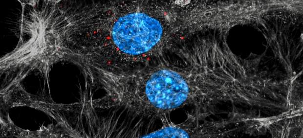 Células endoteliales