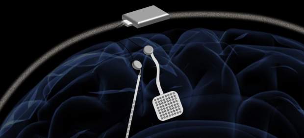 Marcapasos inalámbrico para el cerebro