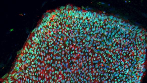 investigadores-japoneses-dan-un-paso-mas-en-el-cultivo-de-rinones-con-celulas-madre