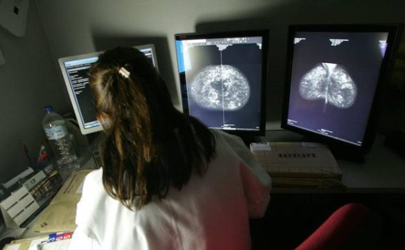 la-contaminacion-tambien-esta-relacionada-con-el-cancer-de-garganta-de-mama-diabetes-ansiedad-y-demencia