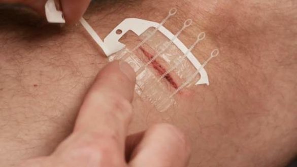 zipstitch-una-nueva-tirita-capaz-de-suturar-heridas-sin-aguja