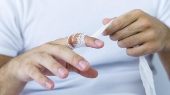 socorro-he-perdido-un-dedo-los-seis-pasos-para-su-reimplantacion-urgente