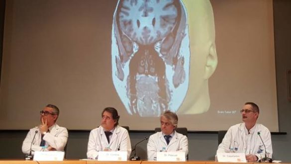 primera-cirugia-laser-en-espana-para-tratar-la-epilepsia
