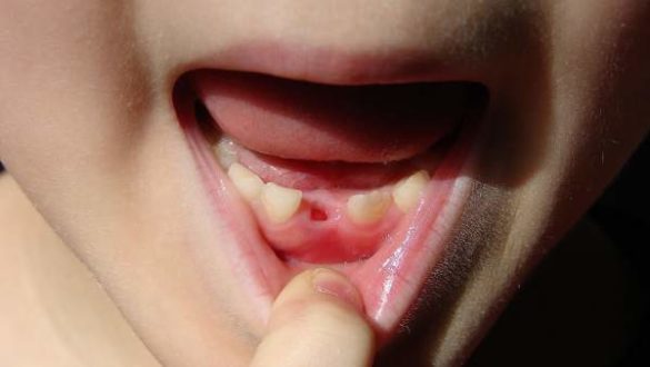 no-te-deshagas-de-los-dientes-de-leche-de-tus-hijos-pueden-salvar-su-vida-en-el-futuro