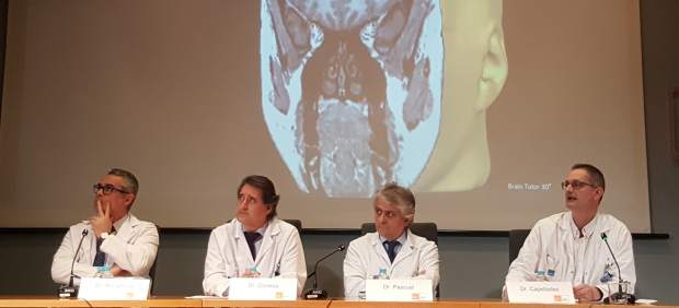 Cirugía láser para la epilepsia