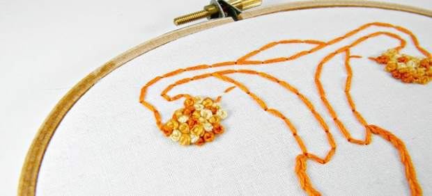 Los síntomas de ovario poliquístico mejoran con la exposición a bacterias intest