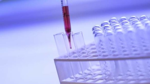 disenan-un-dispositivo-portatil-para-acabar-con-las-biopsias