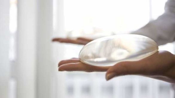 los-cirujanos-aseguran-que-los-implantes-mamarios-son-seguros-pero-hay-que-mantener-revisiones-periodicas