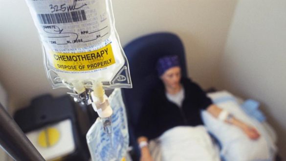 las-mujeres-tienen-mas-probabilidades-de-sobrevivir-al-cancer-pero-sufren-peores-efectos-secundarios