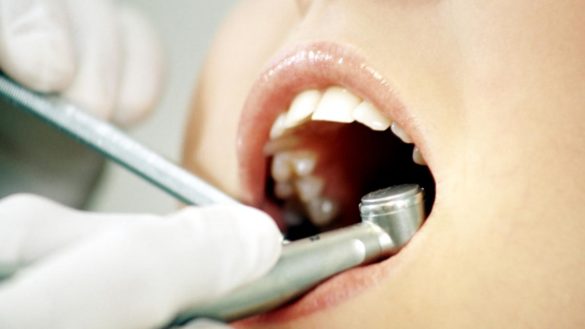 facua-exige-la-retirada-del-set-de-pulido-dental-de-lidl-tras-las-quejas-de-los-odontologos