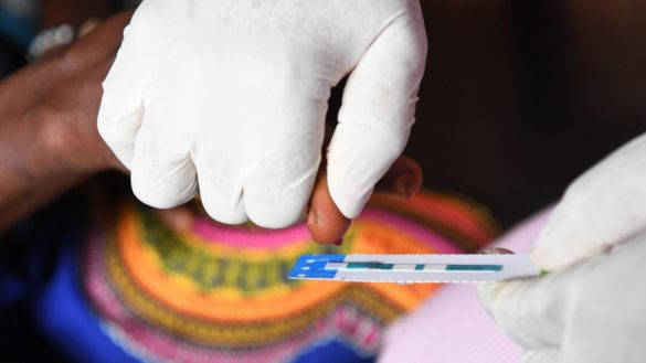 la-terapia-antirretroviral-del-vih-evito-95-millones-de-muertes-en-todo-el-mundo-entre-1995-2015