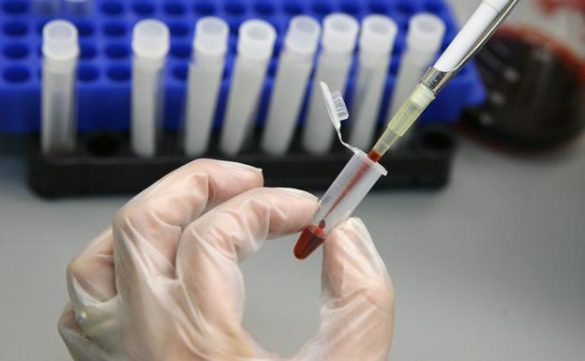 la-hepatitis-c-en-la-frontera-de-la-erradicacion-entre-personas-con-vih