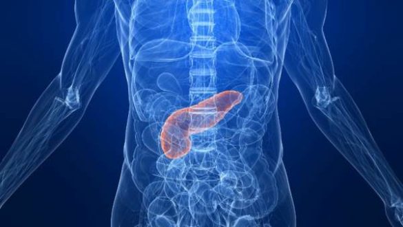 los-casos-de-cancer-de-pancreas-estan-aumentando-y-los-oncologos-ignoran-la-razon