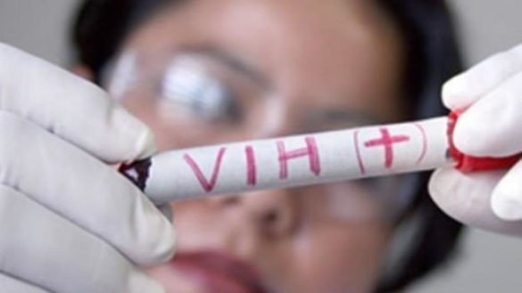 mas-de-37-millones-de-personas-tenian-vih-en-todo-el-mundo-en-2018-y-17-millones-se-contagiaron