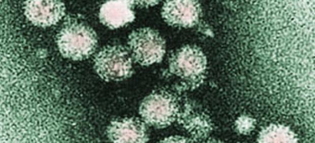 Virus de la hepatitis C