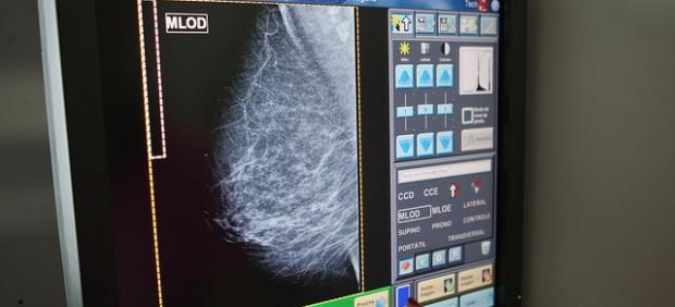 Toledo alberga una cita científica de referencia en cáncer de mama para debatir sobre sus últimos avances
