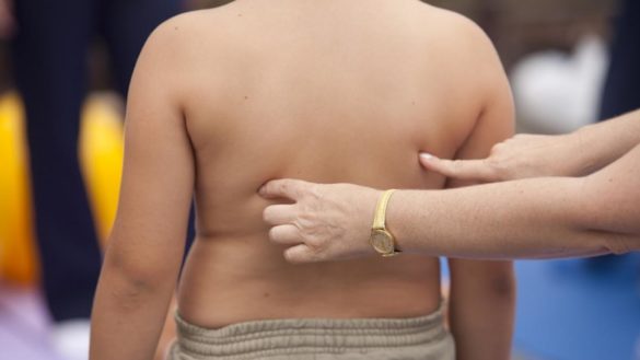 la-obesidad-infantil-se-estabiliza-pero-uno-de-cada-tres-ninos-espanoles-tiene-problemas-de-sobrepeso