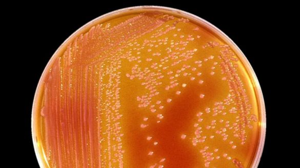 dos-bebes-afectados-por-la-bacteria-8216oportunista8217-serratia-en-el-hospital-materno-infantil-de-granada