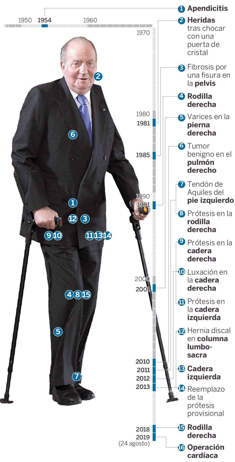 Las 16 intervenciones médicas del Rey Juan Carlos