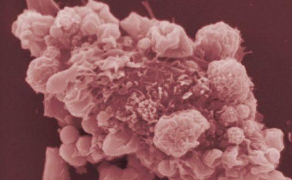 cientificos-espanoles-disenan-una-tecnica-pionera-para-combatir-el-cancer-desde-el-interior-del-tumor