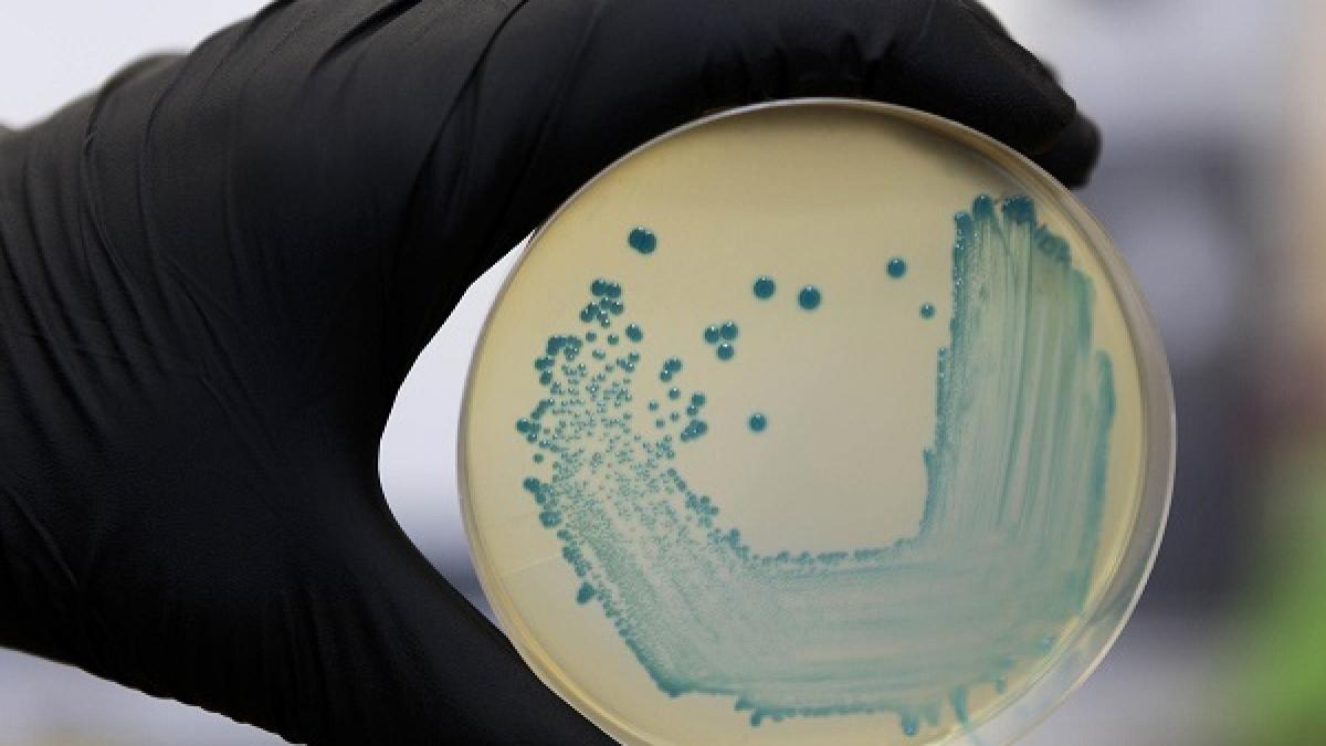 Eleonora Bunsow, microbióloga: «Sorprende el número de afectados por la listeria. No lo esperábamos»