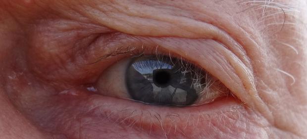 Ojo con cataratas