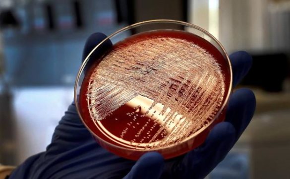 andalucia-cierra-la-alerta-sanitaria-por-la-listeria-ante-el-riesgo-casi-nulo-de-nuevos-casos
