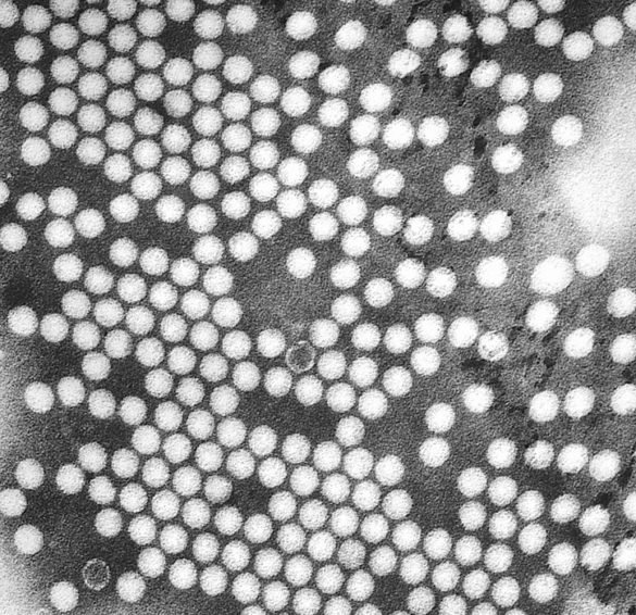 descubren-la-posible-causa-de-una-enfermedad-detectada-en-2012-y-similar-a-la-polio-que-afecta-a-quinientos-ninos