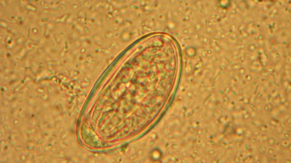 como-prevenir-y-erradicar-las-molestas-lombrices-intestinales